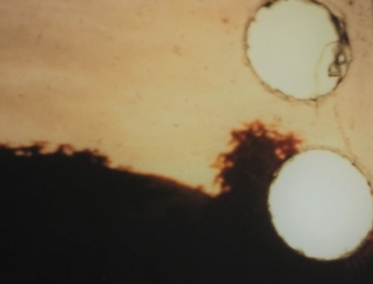 Image of Stopping the Spots 4 by Peter Richards