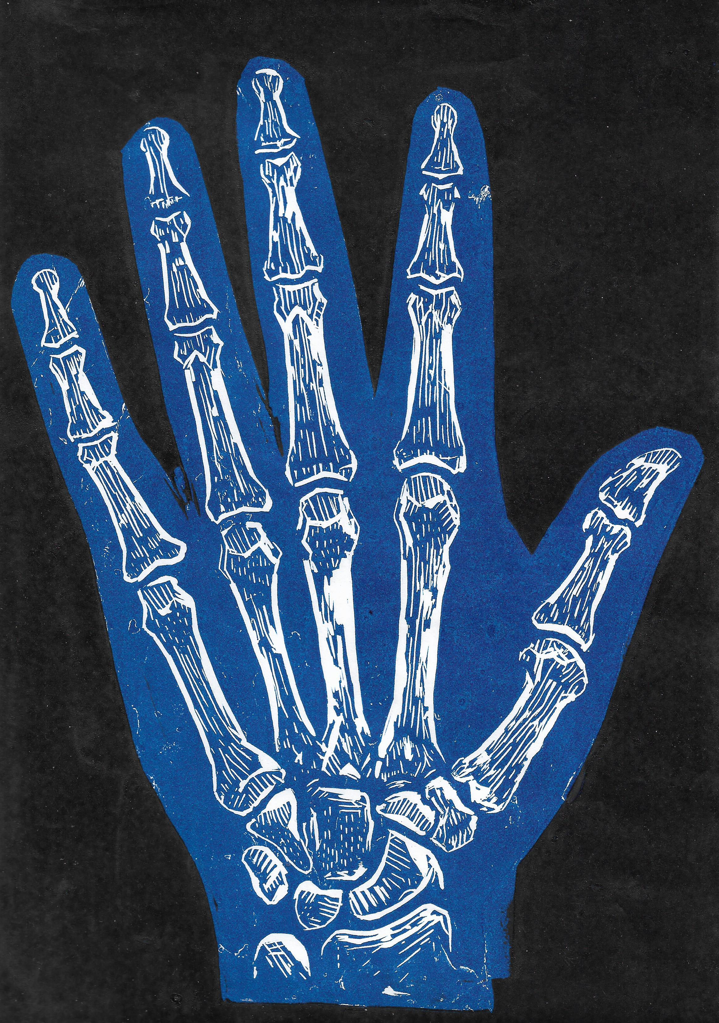 Need a Hand? – ArtisAnn Gallery