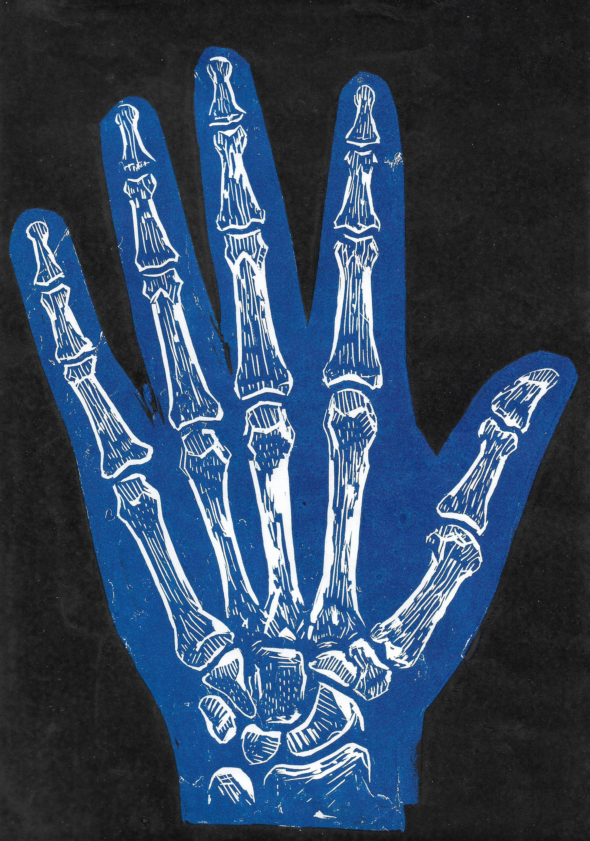 Image of Need a Hand? by Rory McVeigh 