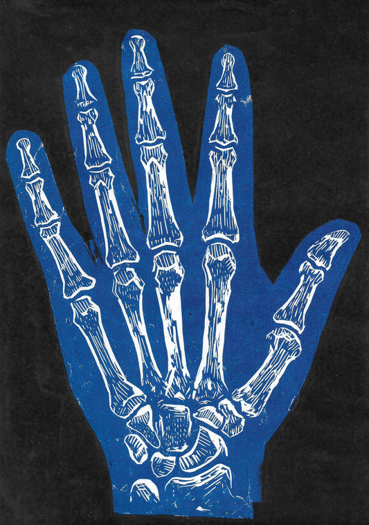 Image of Need a Hand? by Rory McVeigh 